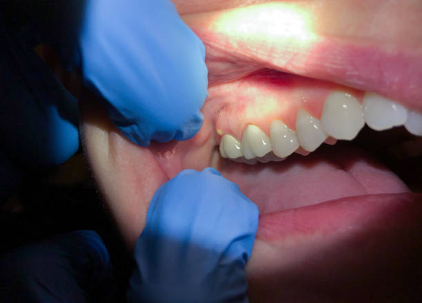 Best Broken or Cracked Tooth Emergency Dentist in Mont Clare, PA